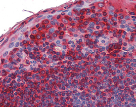 TAK1 polyclonal antibody Immunohistochemistry