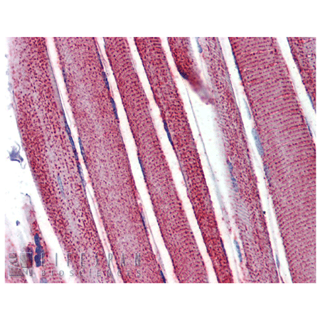 Mn SOD polyclonal antibody Immunohistochemistry