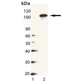 HSP104 (yeast) polyclonal antibody Western blot