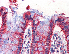 Cpn10 polyclonal antibody Immunohistochemistry
