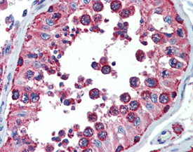 Cpn10 polyclonal antibody Immunohistochemistry