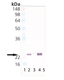 αB-Crystallin polyclonal antibody Western blot