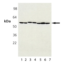 ERp57 monoclonal antibody (MaP.Erp57) Western blot