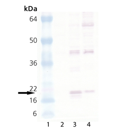 HSP20 polyclonal antibody Western blot