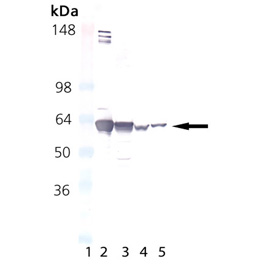 HSP60 monoclonal antibody (LK-1) Western blot