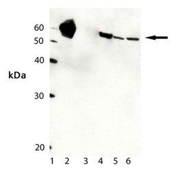 HSP60 polyclonal antibody Western blot