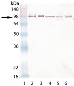 HSP90 polyclonal antibody Western blot