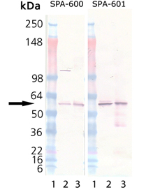 Calreticulin (human), (recombinant) (His-tag) Western blot