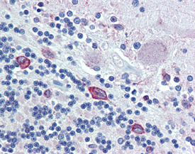 ERp72 polyclonal antibody Immunohistochemistry