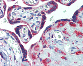 ERp72 polyclonal antibody Immunohistochemistry