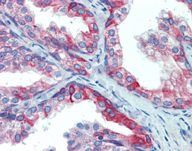 ERp72 polyclonal antibody Immunohistochemistry