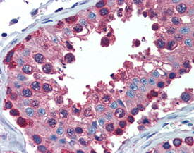 ERp72 polyclonal antibody Immunohistochemistry