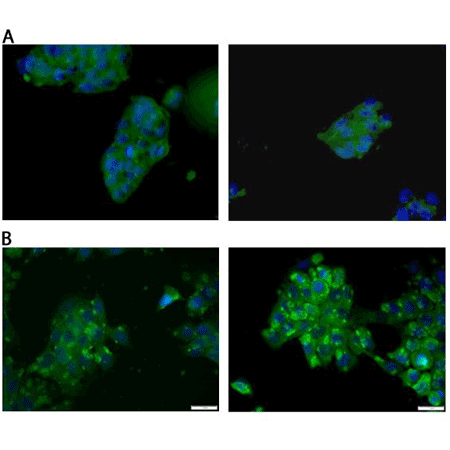 Estrogen receptor alpha monoclonal antibody (C-542) Immunocytochemistry