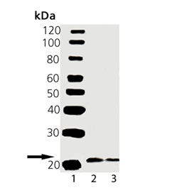 VAMP2 polyclonal antibody Western blot