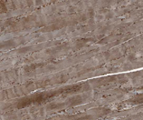Agrin monoclonal antibody (Agr-33) Immunohistochemistry