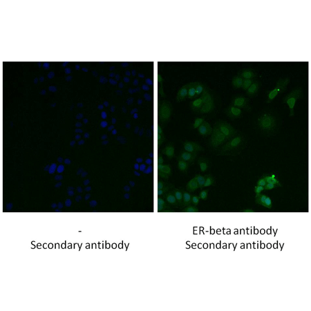 Estrogen receptor β polyclonal antibody Immunofluorescence