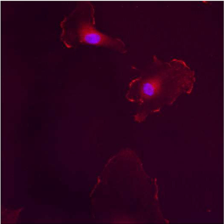 Estrogen receptor β polyclonal antibody Immunofluorescence