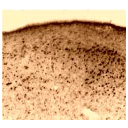 Estrogen receptor β polyclonal antibody Immunohistochemistry