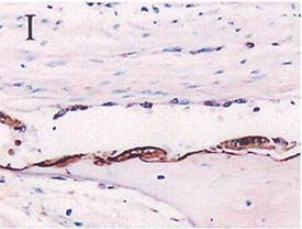 Osteopontin polyclonal antibody Immunohistochemistry