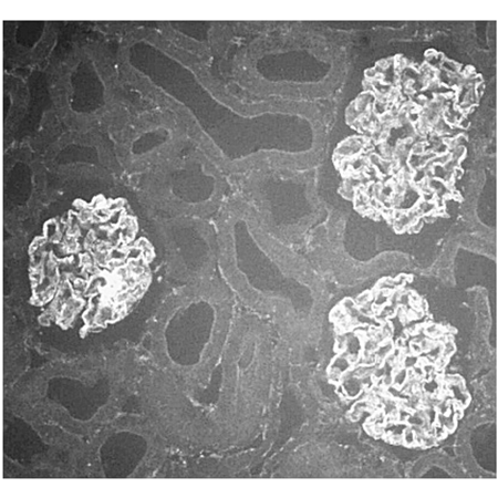 α-Actinin-4 polyclonal antibody Immunohistochemistry