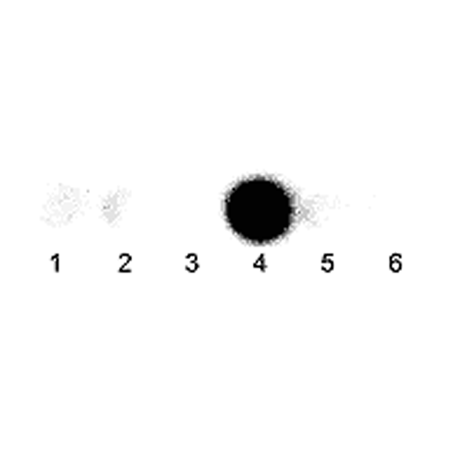 α-Actinin-4 polyclonal antibody Immunoblot