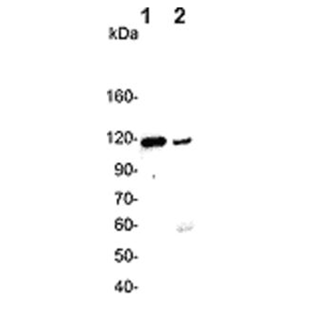 α-Actinin-4 polyclonal antibody Western blot