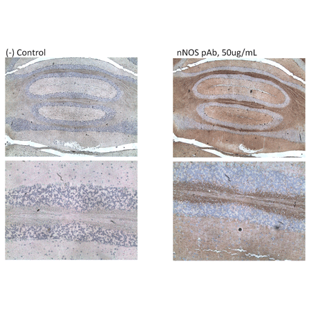 Nitric oxide synthase (neuronal) polyclonal antibody Immunohistochemistry