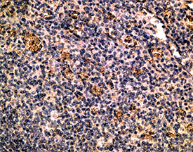CCR6 polyclonal antibody Immunohistochemistry