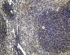 CCR6 polyclonal antibody Immunohistochemistry