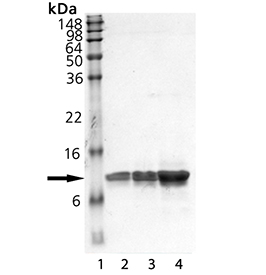 β2-Microglobulin (human), (native) SDS-PAGE