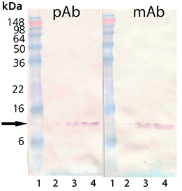 β2-Microglobulin (human), (native) Western blot