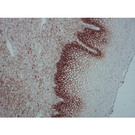 CD44std (human) monoclonal antibody (SFF-304) Immunohistochemistry