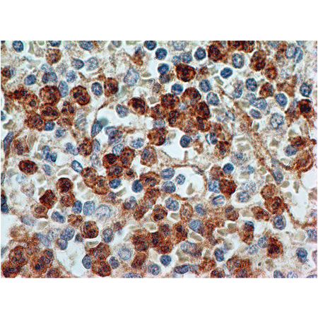 Toll-like receptor 9 monoclonal antibody (26C593.2) Immunohistochemistry