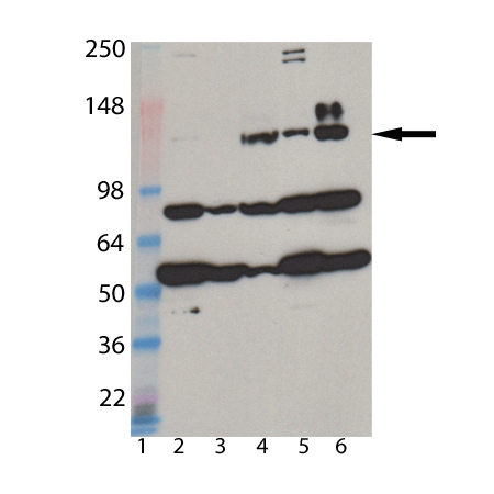 MDA5 monoclonal antibody (1B6) Western blot