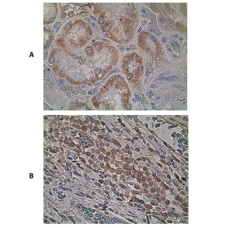 TRAIL-R4 (human) monoclonal antibody (01) Immunohistochemistry