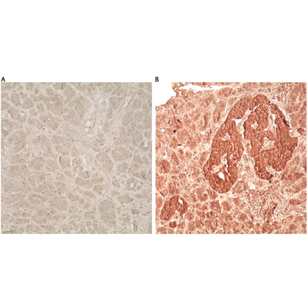 Glucagon like peptide 1 polyclonal antibody Immunohistochemistry