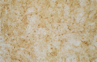 Glutamic acid decarboxylase polyclonal antibody Immunohistochemistry