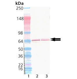 Glutamic acid decarboxylase polyclonal antibody Western blot
