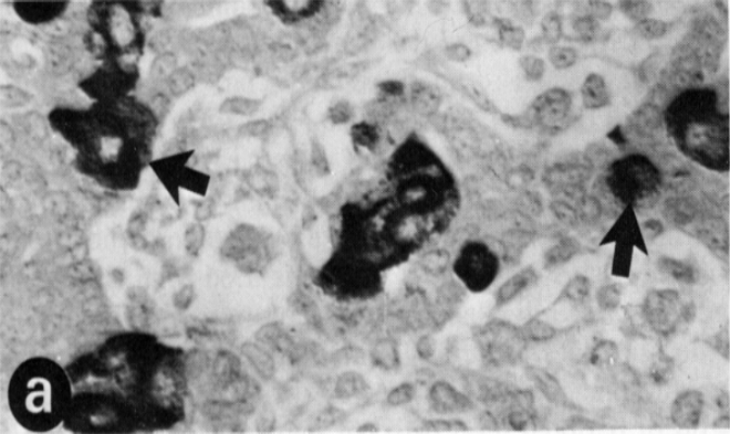 Peptide tyrosine tyrosine polyclonal antibody Immunohistochemistry