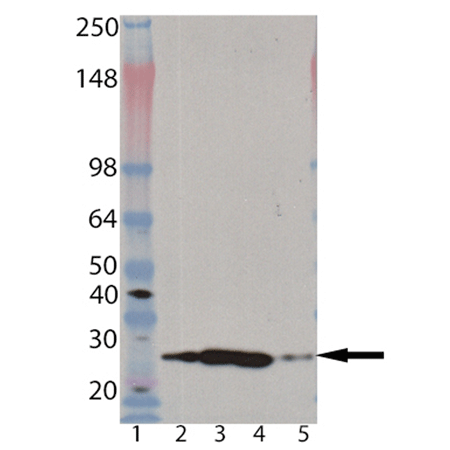 Proteasome 20S α2 subunit monoclonal antibody (MCP21) Western blot