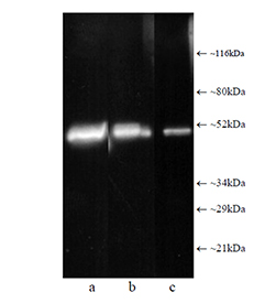Proteasome 19S Rpt1/S7 subunit monoclonal antibody (MSS1-104) Western blot