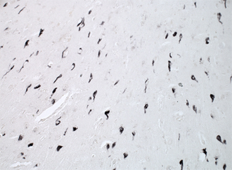 p62 (human) polyclonal antibody Immunohistochemistry