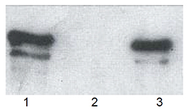 p62 (human) polyclonal antibody Western blot