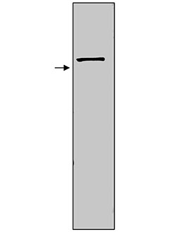 Nitric oxide synthase (inducible) polyclonal antibody Western blot