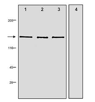 nNOS polyclonal antibody Western blot
