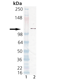 PARP polyclonal antibody Western blot
