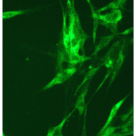 HIF-1α monoclonal antibody (H1α67) Immunocytochemistry