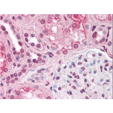 HIF-1α monoclonal antibody (H1α67) Immunohistochemistry