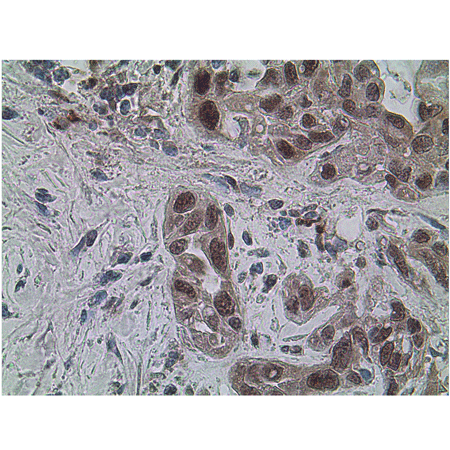 SIRT1 (human) polyclonal antibody Immunohistochemistry