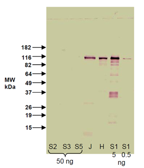 SIRT1 (human) polyclonal antibody Western blot